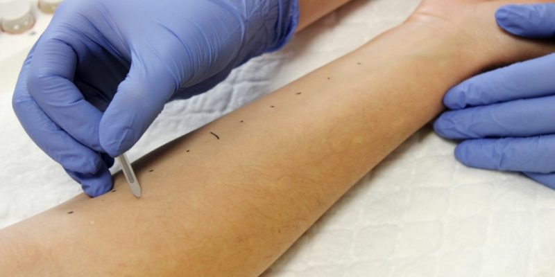 Vinalopó y Torrevieja ofrecen pautas a los pacientes para diferenciar la alergia primaveral de la infección por Covid19