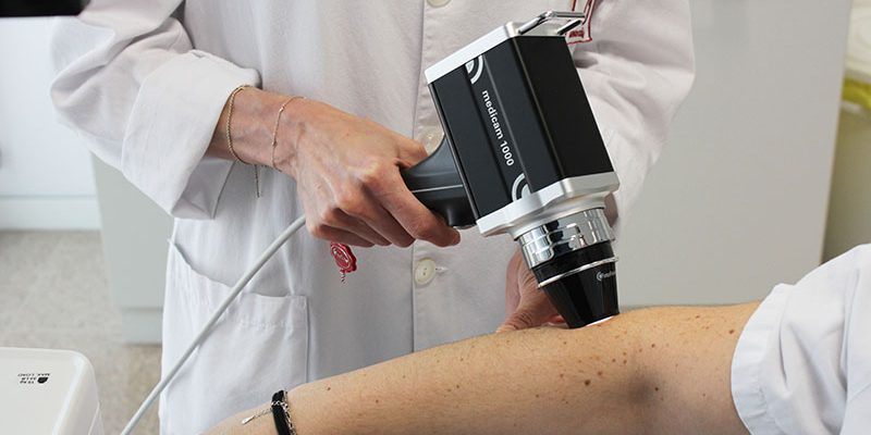 El Hospital Universitario del Vinalopó incorpora en el servicio de dermatología el equipo de mapeo corporal automatizado más avanzado del mundo