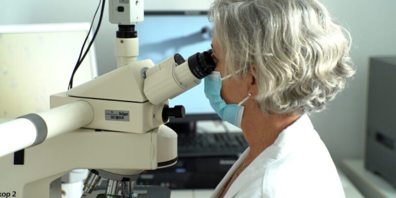 El Área de la Mama del Hospital Universitario del Vinalopó revoluciona el diagnóstico del cáncer de mama y hace la firma genética en la biopsia inicial