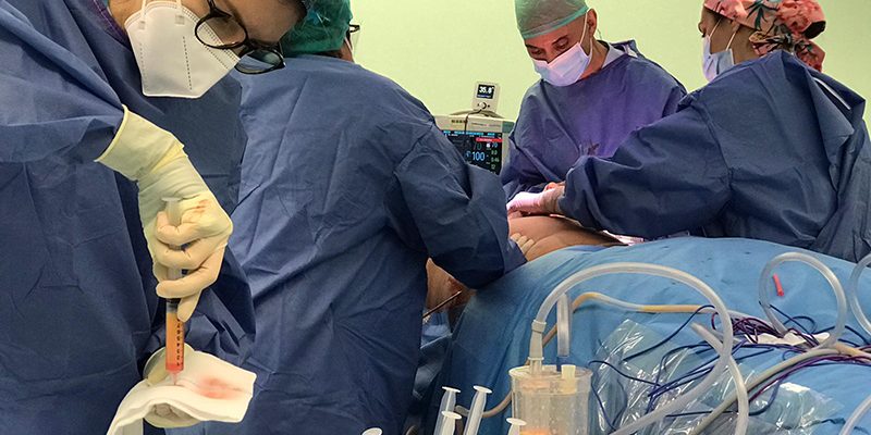 El Hospital Universitario del Vinalopó implanta un protocolo de alta precoz en mujeres mastectomizadas con reconstrucción inmediata para su recuperación domiciliaria￼
