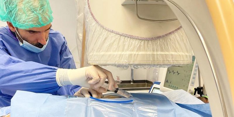 El Hospital Universitario del Vinalopó implanta una técnica novedosa para eliminar taquicardias ventriculares