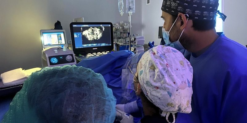 El Hospital Universitario del Vinalopó realiza con éxito la primera sesión de cirugía con radiofrecuencia para tratar miomas uterinos